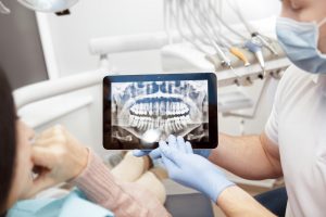Tại sao phải chụp X-Quang răng khi khám nha khoa?