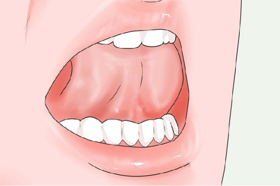 Thói quen xấu gây nên những ảnh hưởng đến kết quả niềng răng