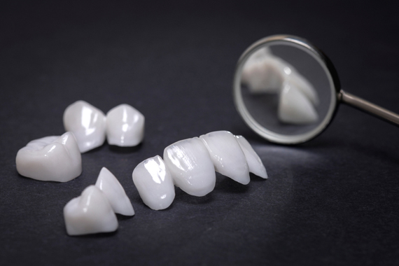 Răng sứ toàn sứ - Những ưu và nhược điểm của loại sứ này?