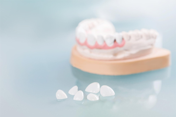 Răng sứ: Những điều quan tâm nhất dành cho người muốn làm răng sứ